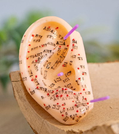 Ohrmodell Akupunktur Nadeln PhysioNatura Wipperfuerth